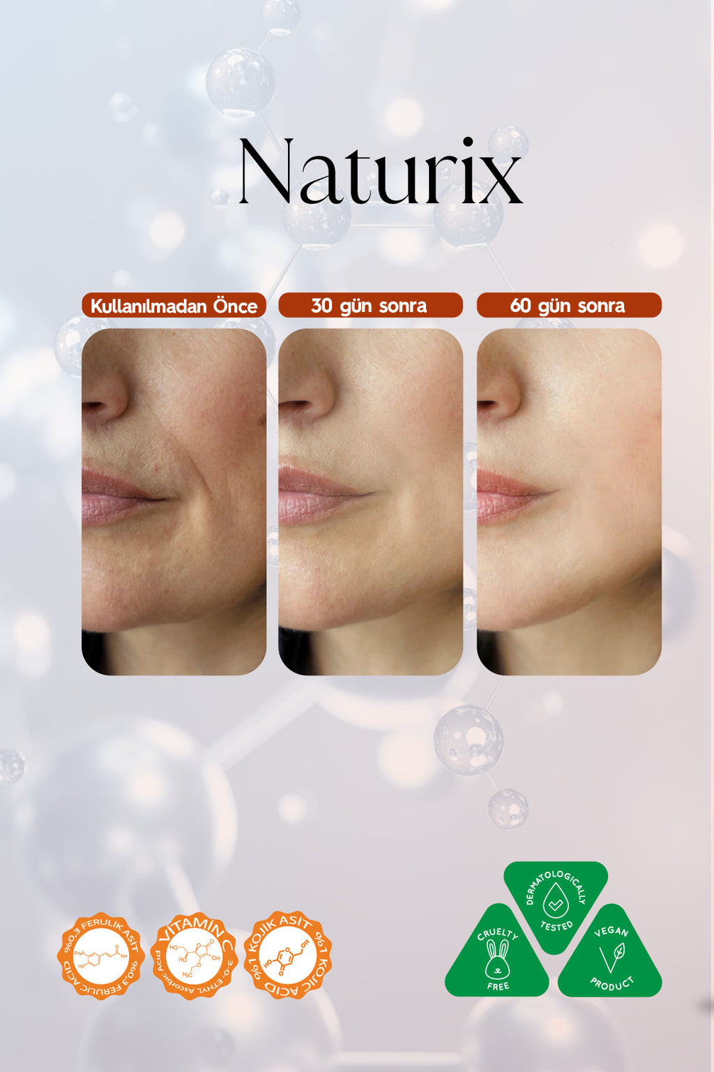 Kojik Asit Yüz Bakım Kremi - Leke Karşıtı, Aydınlatıcı, Cilt Tonu Eşitleyici, Niacinamide 50ml