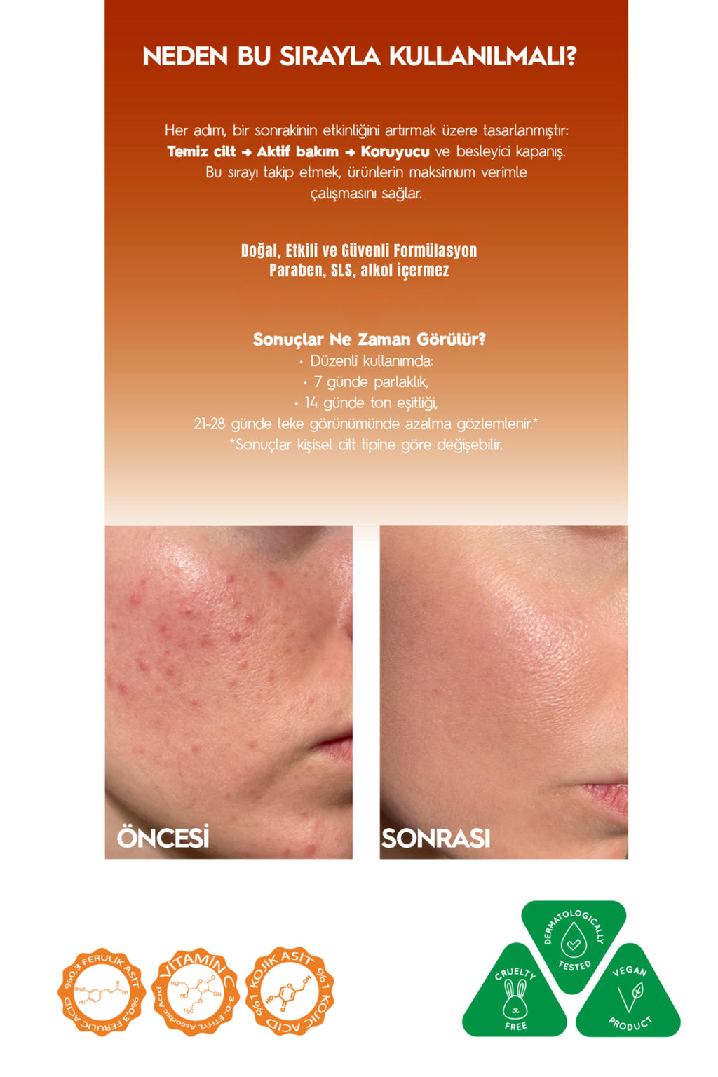 Kojik Asitli 3'lü Leke Karşıtı Cilt Bakım Seti | Sabun 100 gr + Serum 30ml + Krem 50 ml
