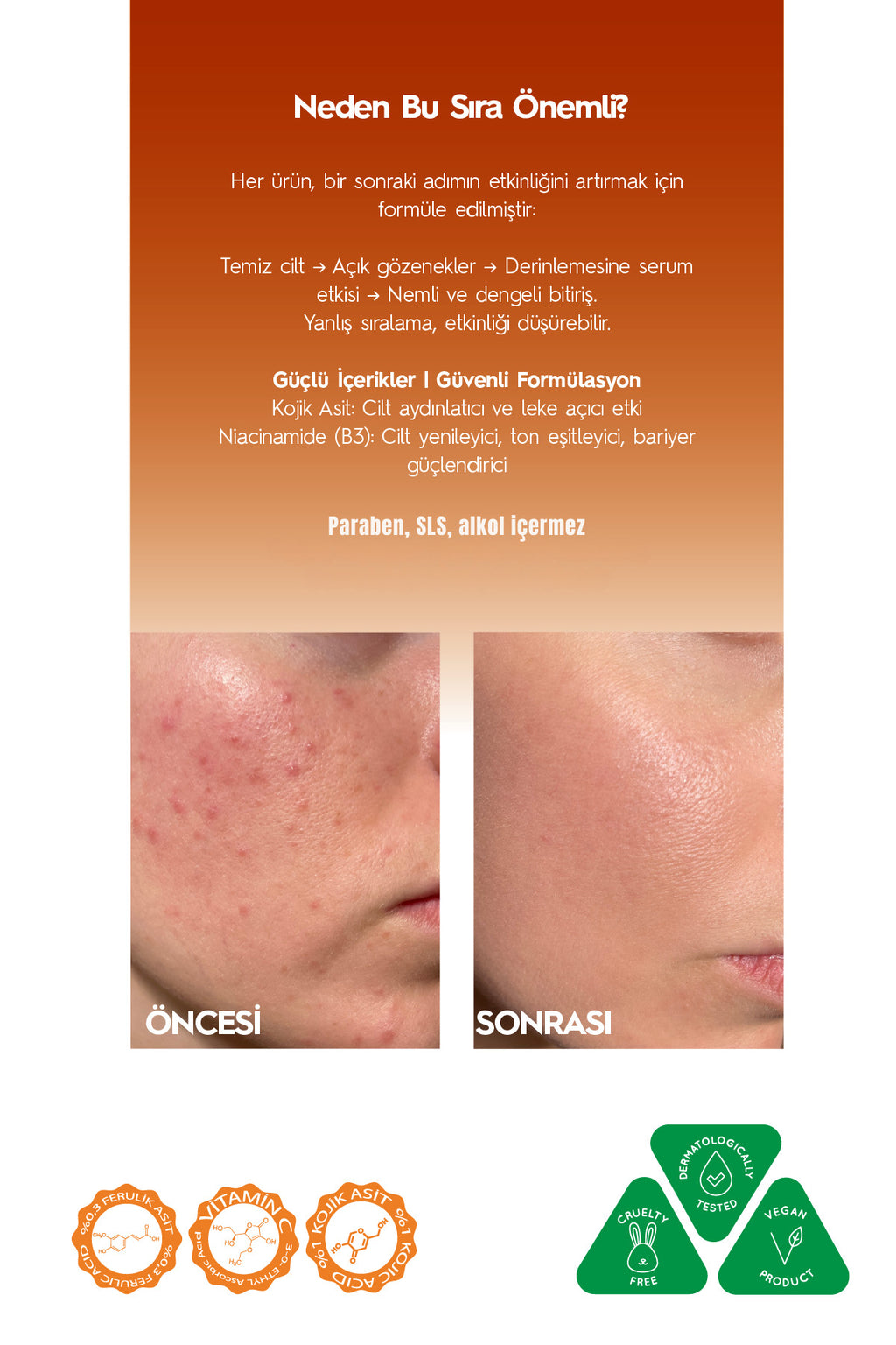 Kojik Asitli 3'lü Leke Karşıtı Bakım Seti | Yüz Temizleme Jeli 250 ml + Serum 30 ml + Krem 50 ml